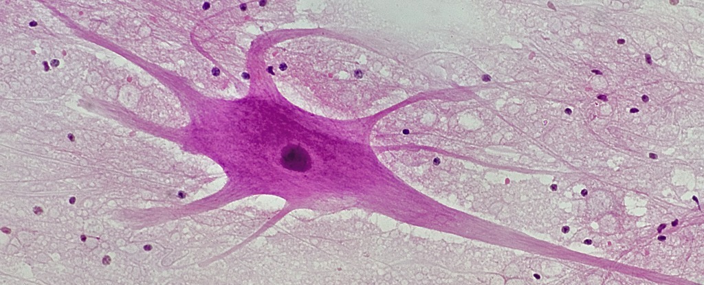 New Check Detects Parkinson’S 7 Years Ahead Of Maximum Signs Display : Sciencealert